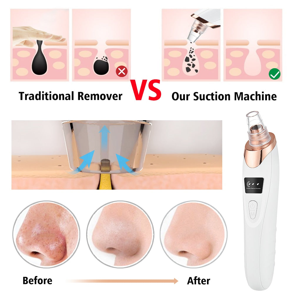 Sebum Suction Machine