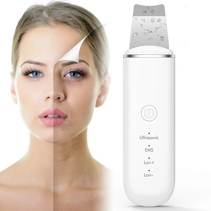 Premium Ultrasonic Skin Scrubber