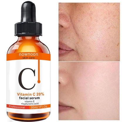 Vitamin C Serum™