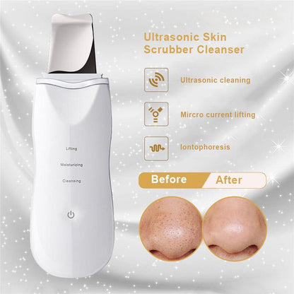 Premium Ultrasonic Skin Scrubber